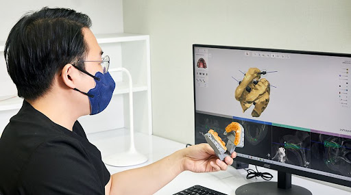 천안 임플란트 치료 방법